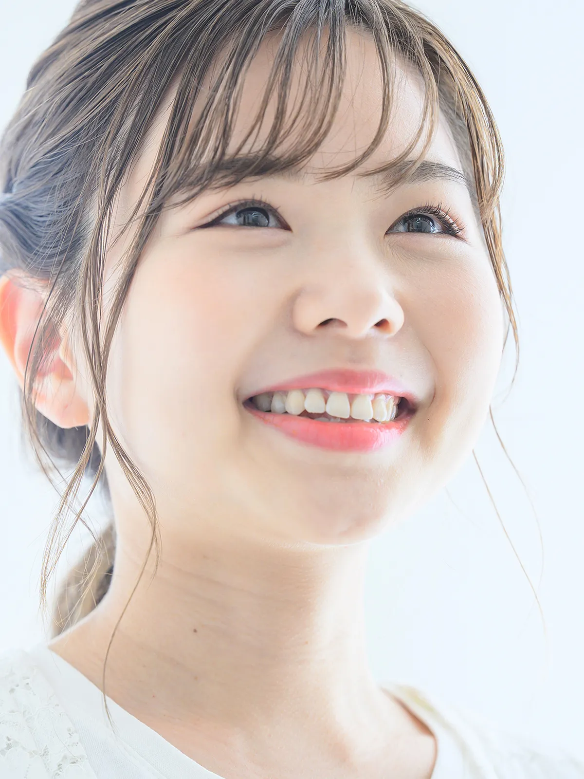ラミネートベニア